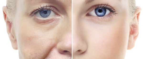 Yüzde Antiaging Uygulamaları